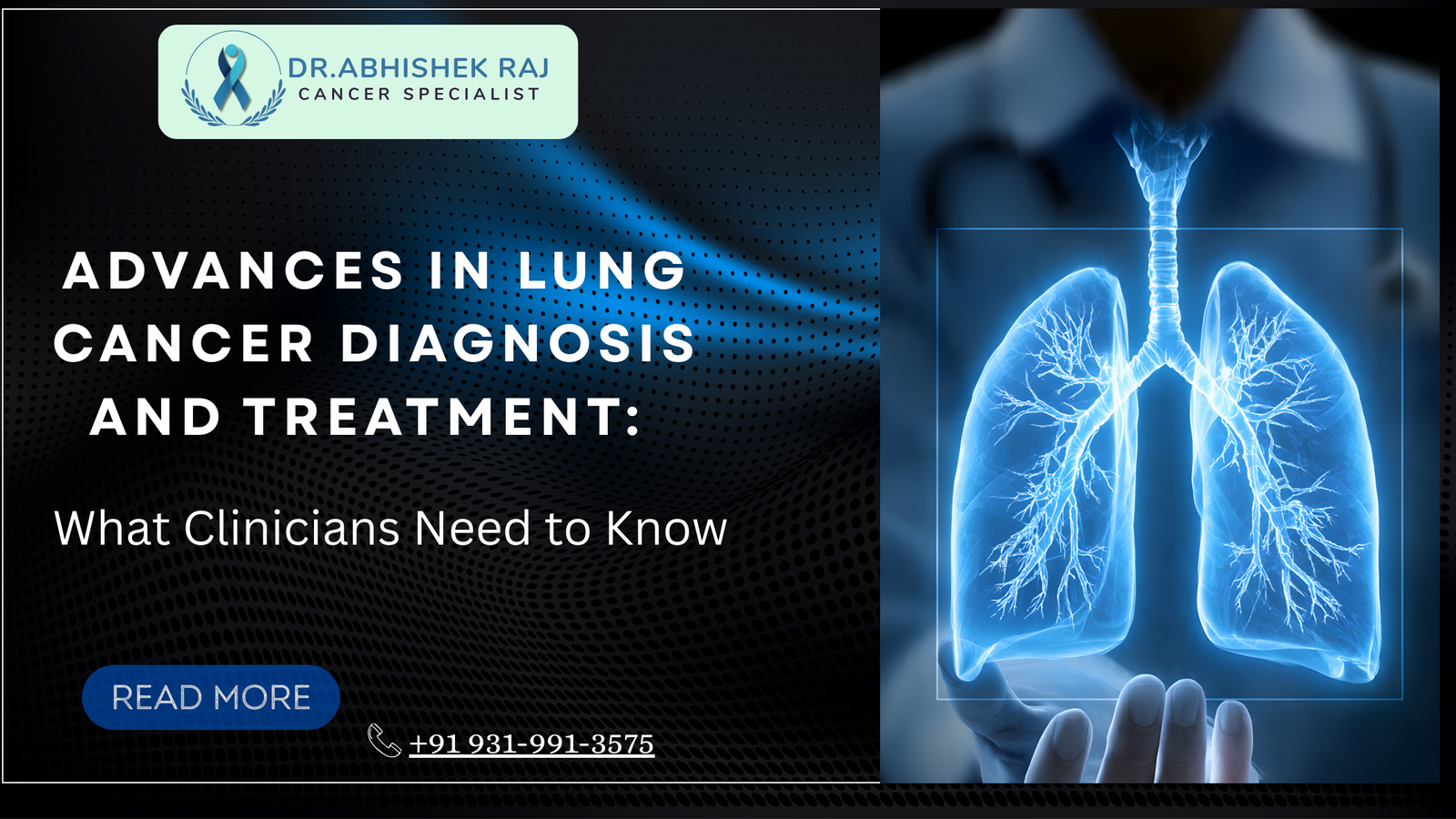 Advances in Lung Cancer Diagnosis and Treatment: What Clinicians Need to Know