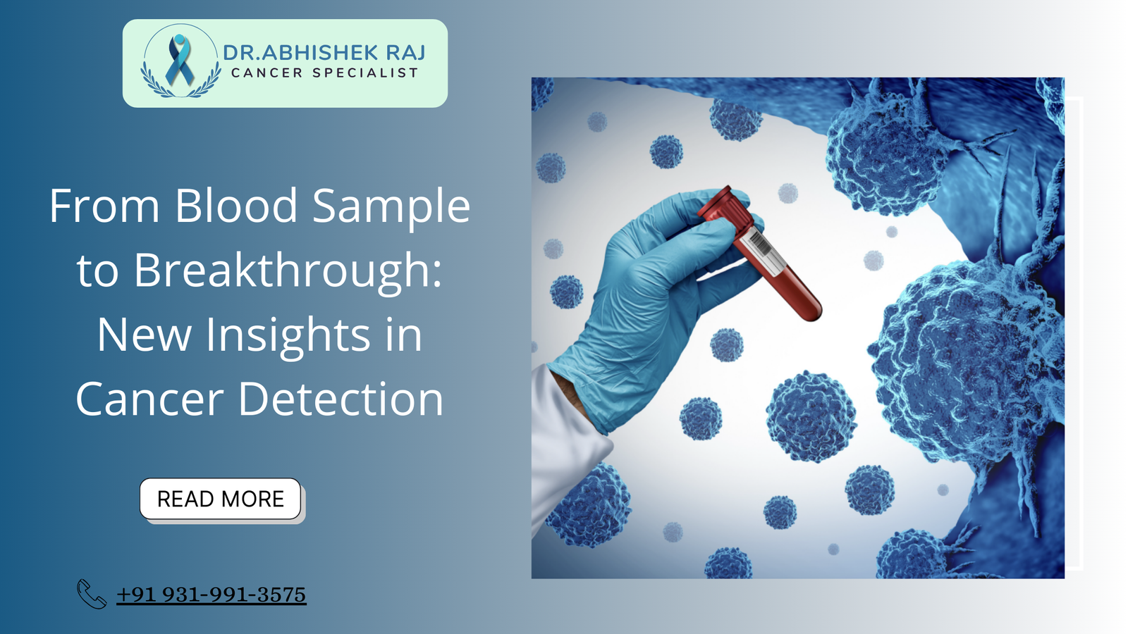 From Blood Sample to Breakthrough: New Insights in Cancer Detection